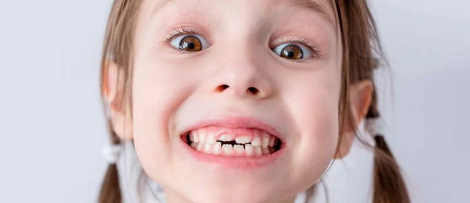 Dente de Leite: Quando Cai e Como Cuidar